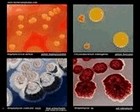 bacteria pigment production
